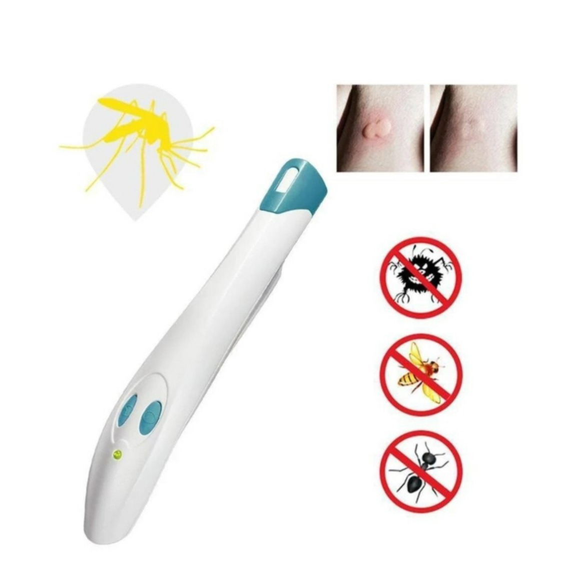 Image of Elektrischer Anti-Itch Juckreiz Stift Mücken / Insekten Stich Heiler (Batteriebetrieben) bei Apfelkiste.ch